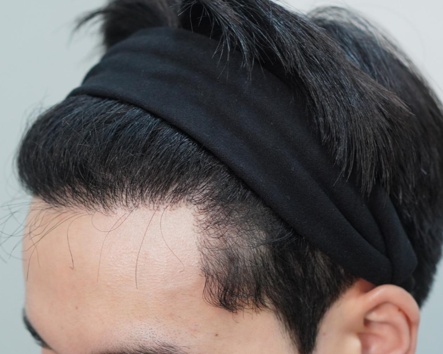 3000모 무삭발 1년차