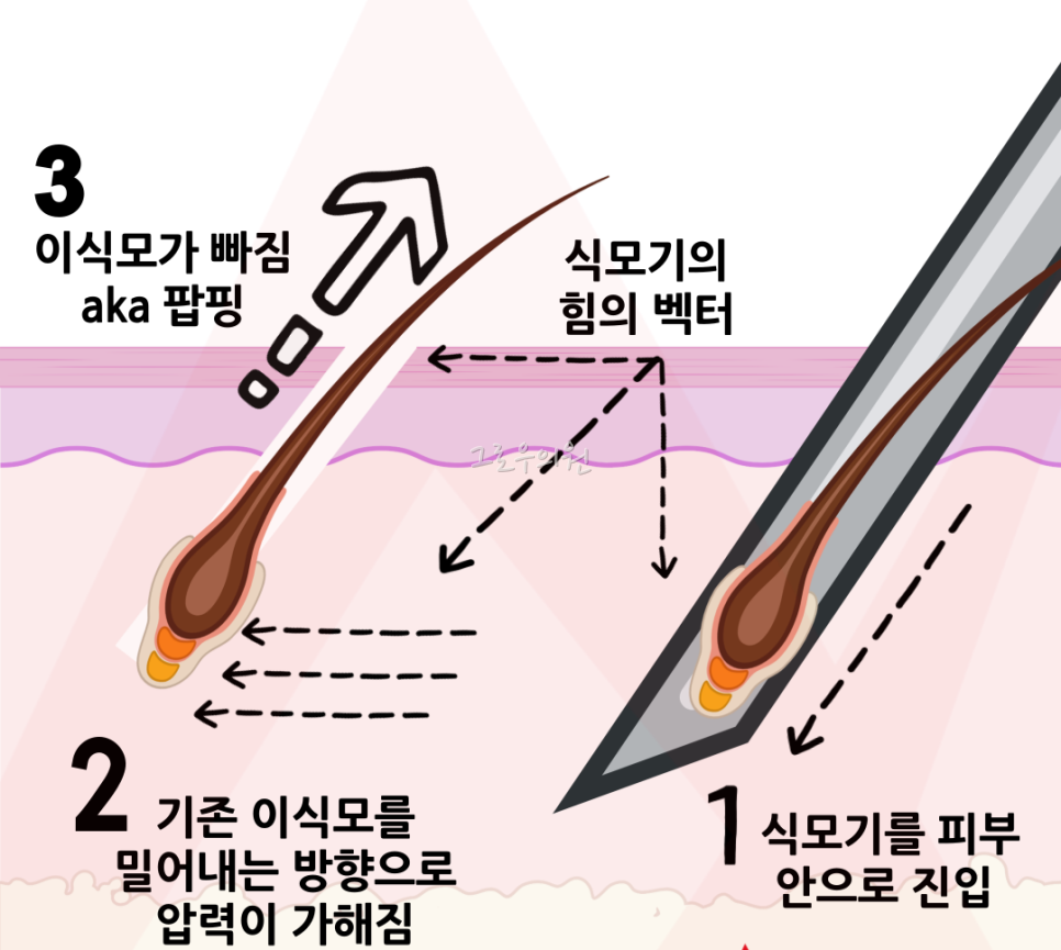 식모기 팝핑 현상 설명 일러스트