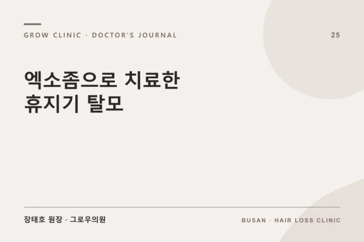엑소좀으로 치료한 휴지기 탈모 글 썸네일