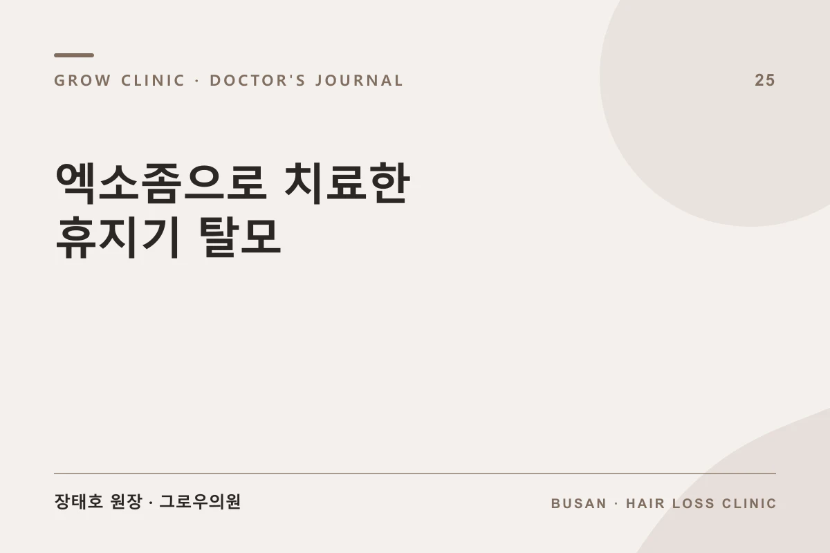 엑소좀으로 치료한 휴지기 탈모 글 썸네일