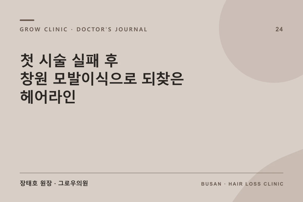 첫 시술 실패 후 창원 모발이식으로 되찾은 헤어라인 글 썸네일