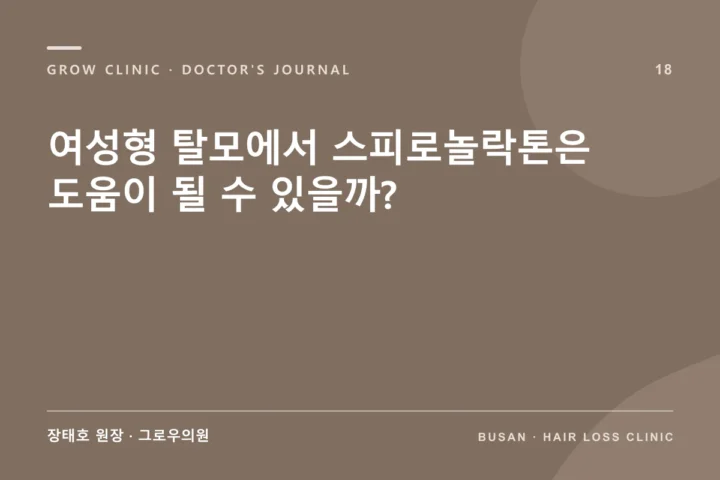 여성형 탈모에서 스피로놀락톤은 도움이 될 수 있을까?