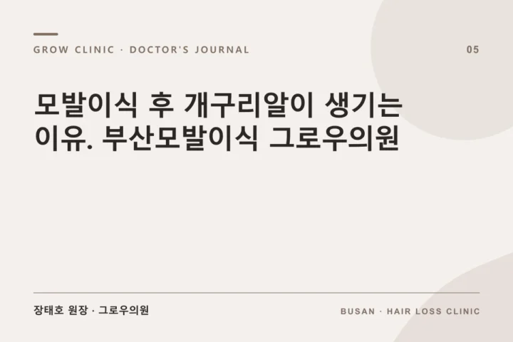 모발이식 후 개구리알이 생기는 이유. 부산모발이식 그로우의원